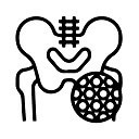 STRONG BONES